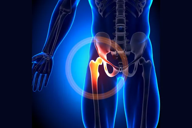 Multifocal Inflammatory Disease